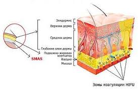 smas 1